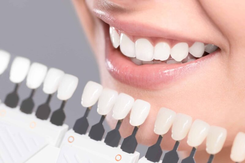 Cosmetic Dentistry Marlton