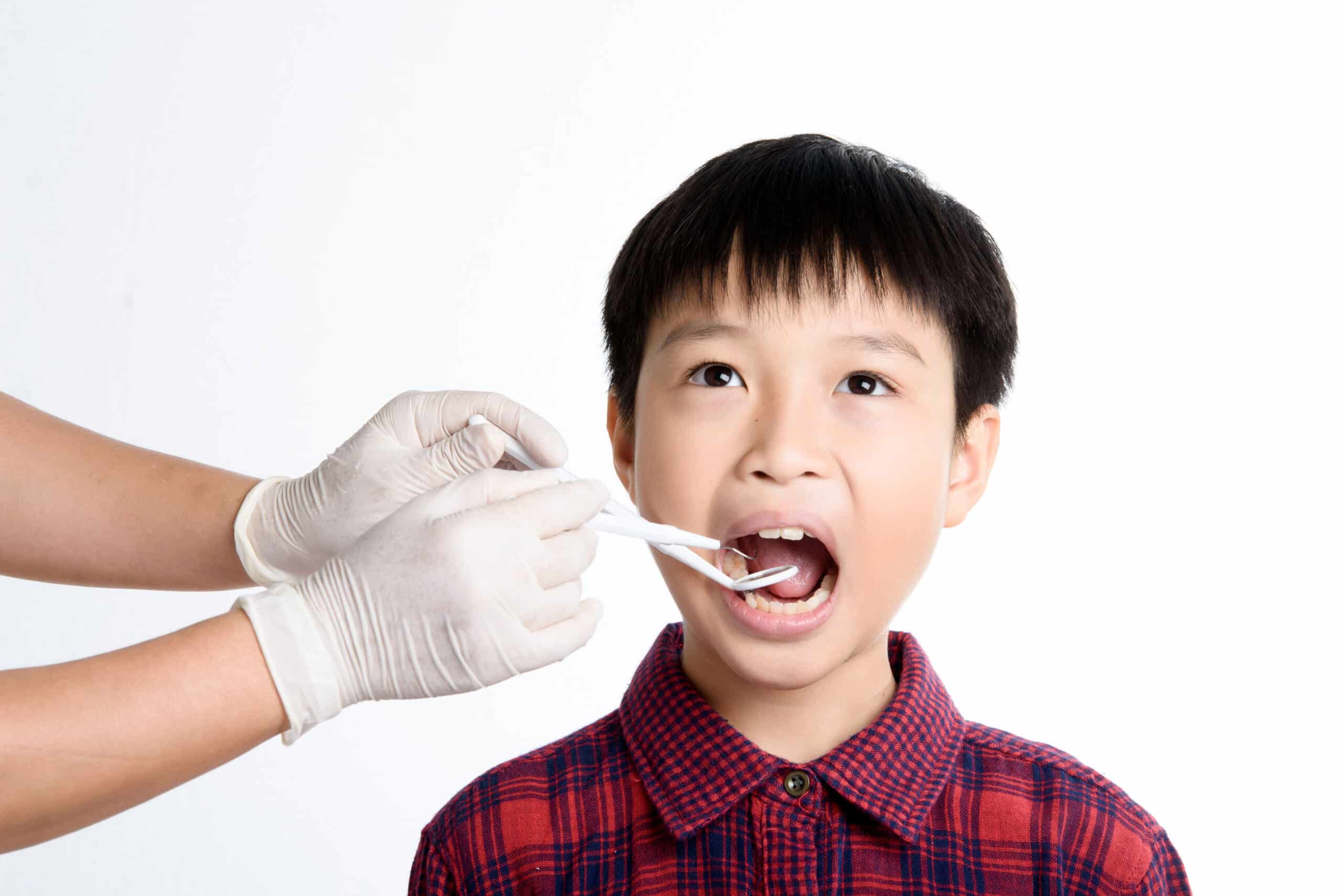 Fluoride Treatment Marlton
